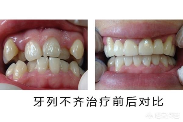 黔东最新24小时牙医在线咨询方法分析(最方便真实的黔东有没有24小时牙医方法)