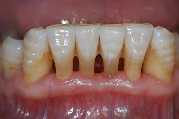 黔东最新24小时牙医在线咨询方法分析(最方便真实的黔东有没有24小时牙医方法)